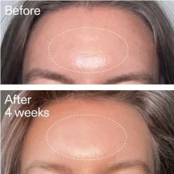 Advanced Retinal Serum