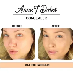 Anne T. Dote Concealer