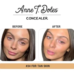 Anne T. Dote Concealer