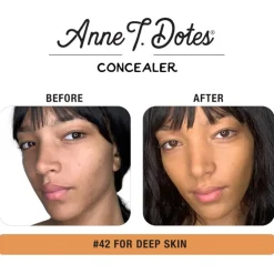 Anne T. Dote Concealer