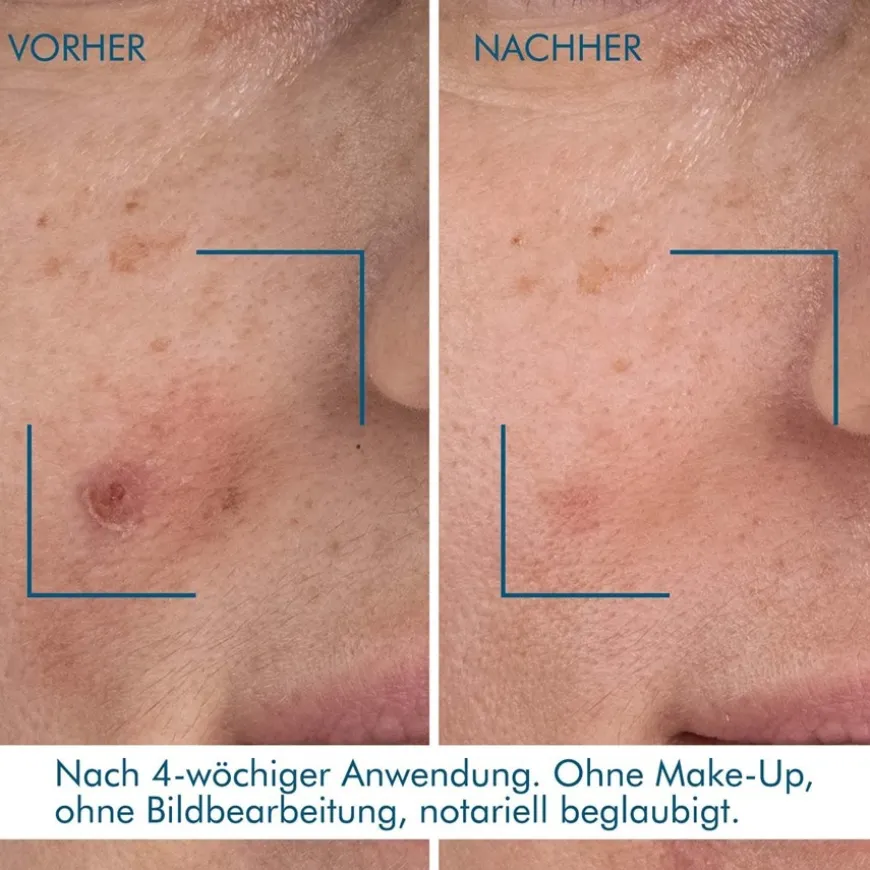 Blue Retinol Resurface + Repair Night Serum