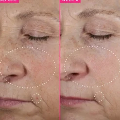 Brighten Up 3% TXA Dark Spot Toner