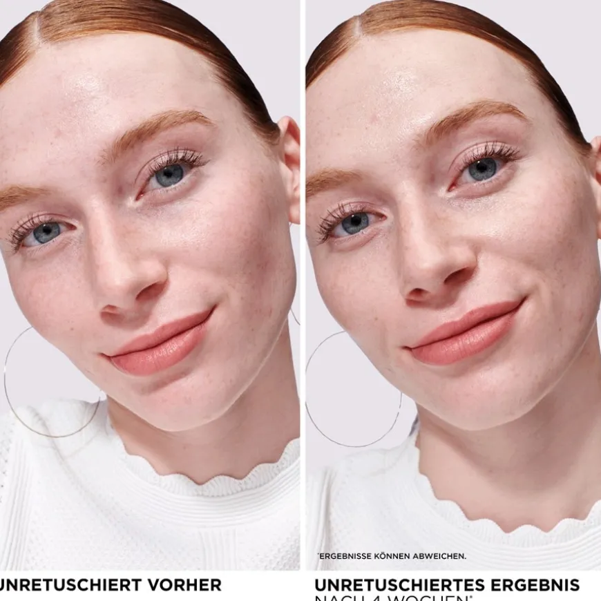 Bye Bye Redness Serum