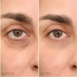 C - Concentrated Eye Cream