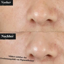 Clearly Corrective Dark Spot Solution