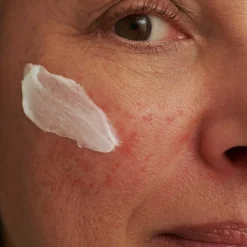 GEZICHTSMASKER, - voor overgevoelige huid & couperose