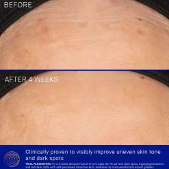 Het vitamine C-serum