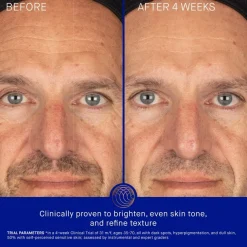 Het vitamine C-serum