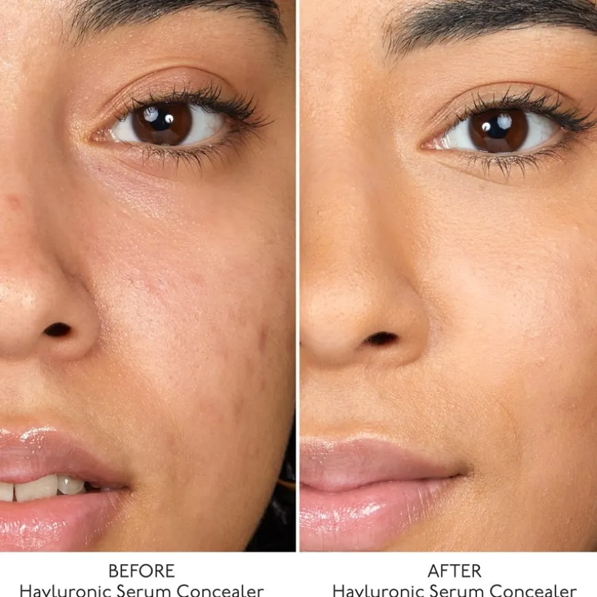 Hyaluron Serum Concealer