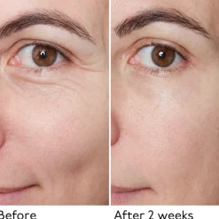 Hyaluronisch Globaal Serum