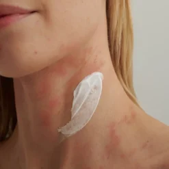 INTENSIEVE CRÈME, - Voor droge huid en neurodermitis