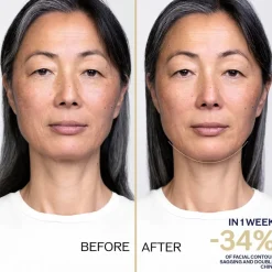 LiftDefine Radiance Night Concentrate