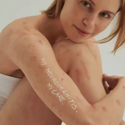 OOGCRÈME, - Voor droge huid en neurodermitis