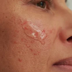 REINIGINGSGEL, - voor overgevoelige huid & couperose