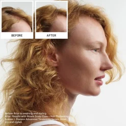 Scalp & Hair Treatment, Natural Hair Light Thinning