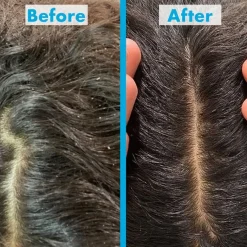 Scalp Reviving Anti-Dandruff Shampoo