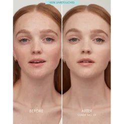 Stichting Glazen Huid