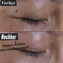 Super Multi-Corrective Eye Zone Treatment