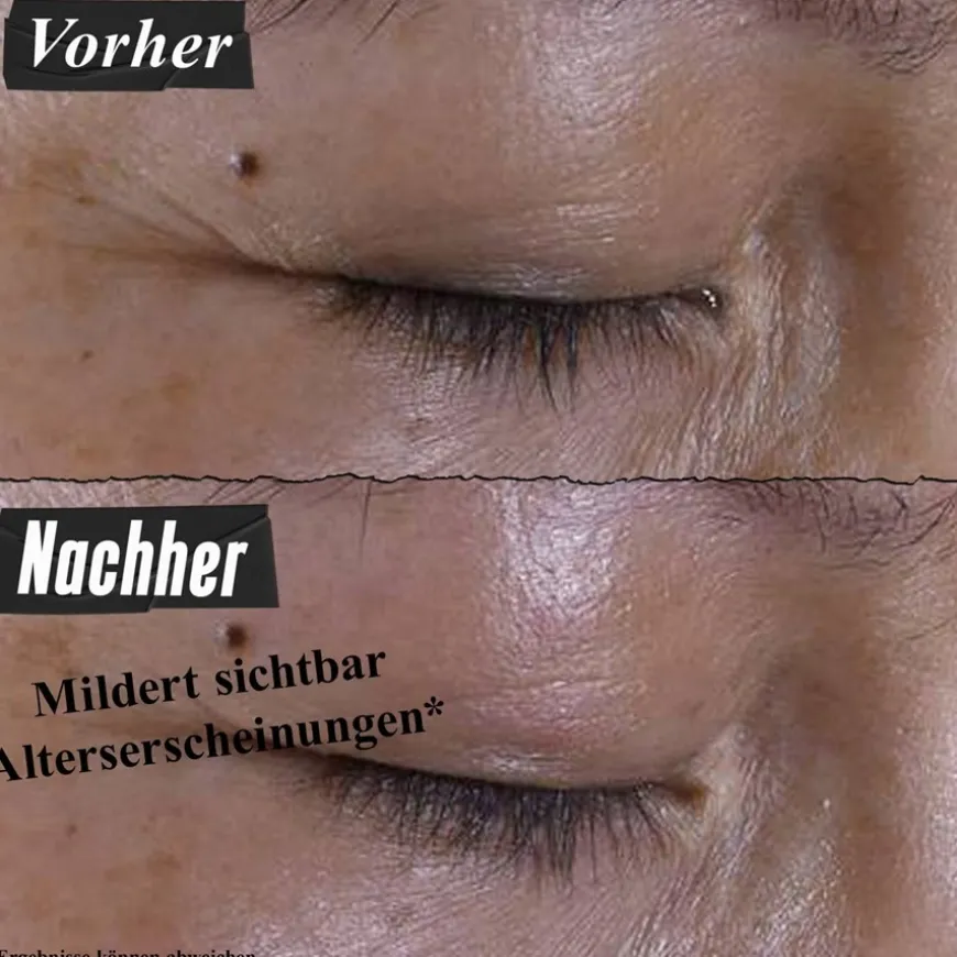 Super Multi-Corrective Eye Zone Treatment