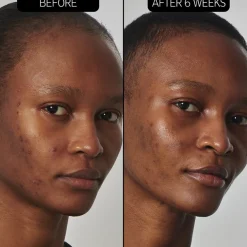 SuperSolutions 20% Niacinamide Serum