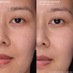 The Porefessional Hydro Pop