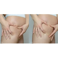 Verstevigend lichaamsserum