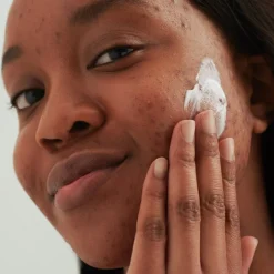 WASCRÈME, - voor onzuivere huid