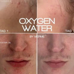Zuurstofwater van Merme 4-weeks set